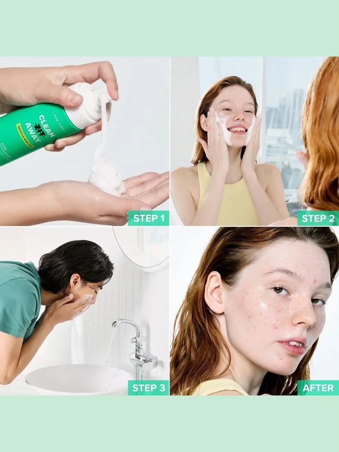 I DEW CARE CLEAN ZIT AWAY ACNE FOAMING CLEANSER | One Colour-Image 3